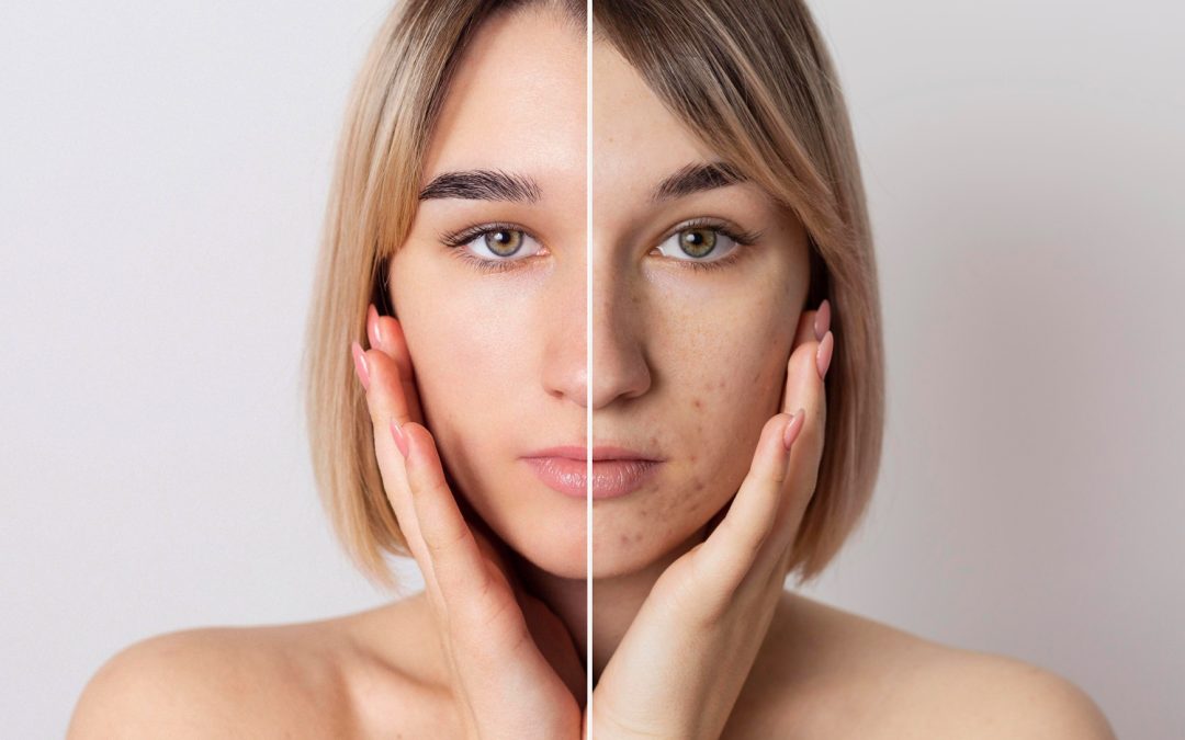 Skin Problems and Doc’s Treatments