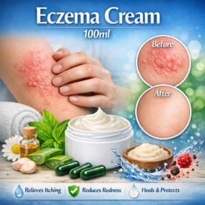 Eczema Cream 100ml
