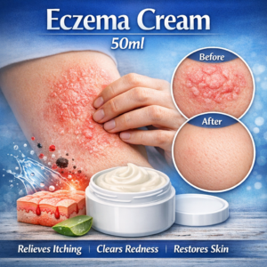 Eczema Cream 50ml